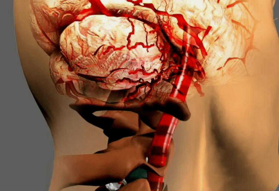 Como osteocondrose cervical, é perigoso