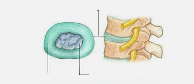 Tipo de osteocondrose